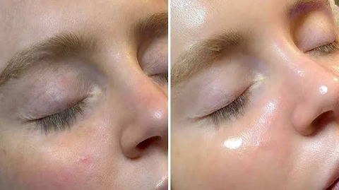 Gommagic Super Facial